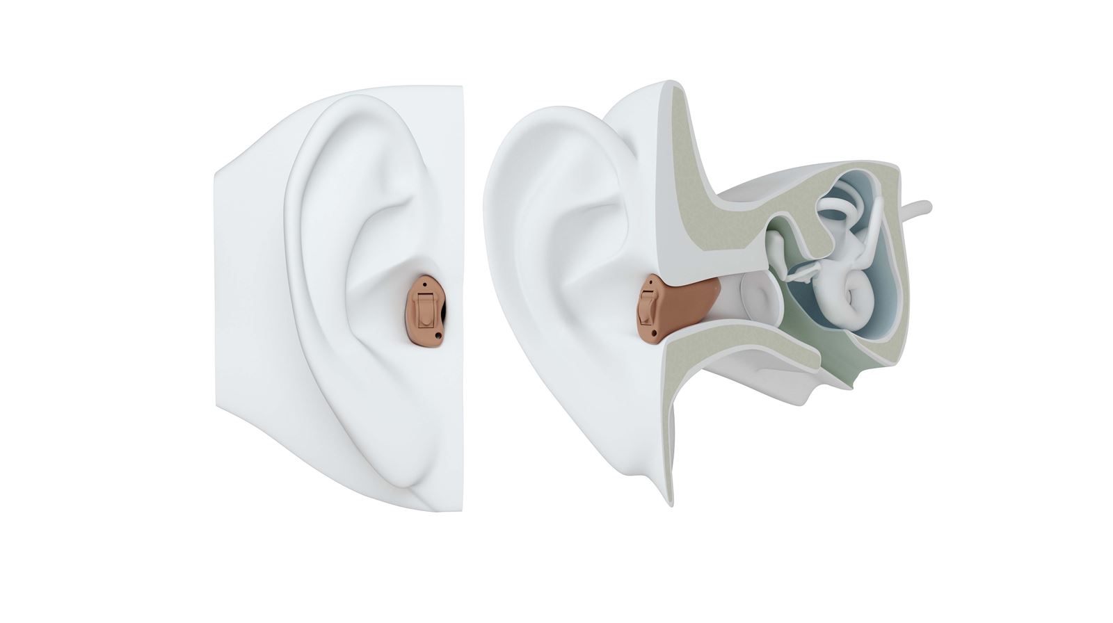 ReSound CIC Hearing Aid