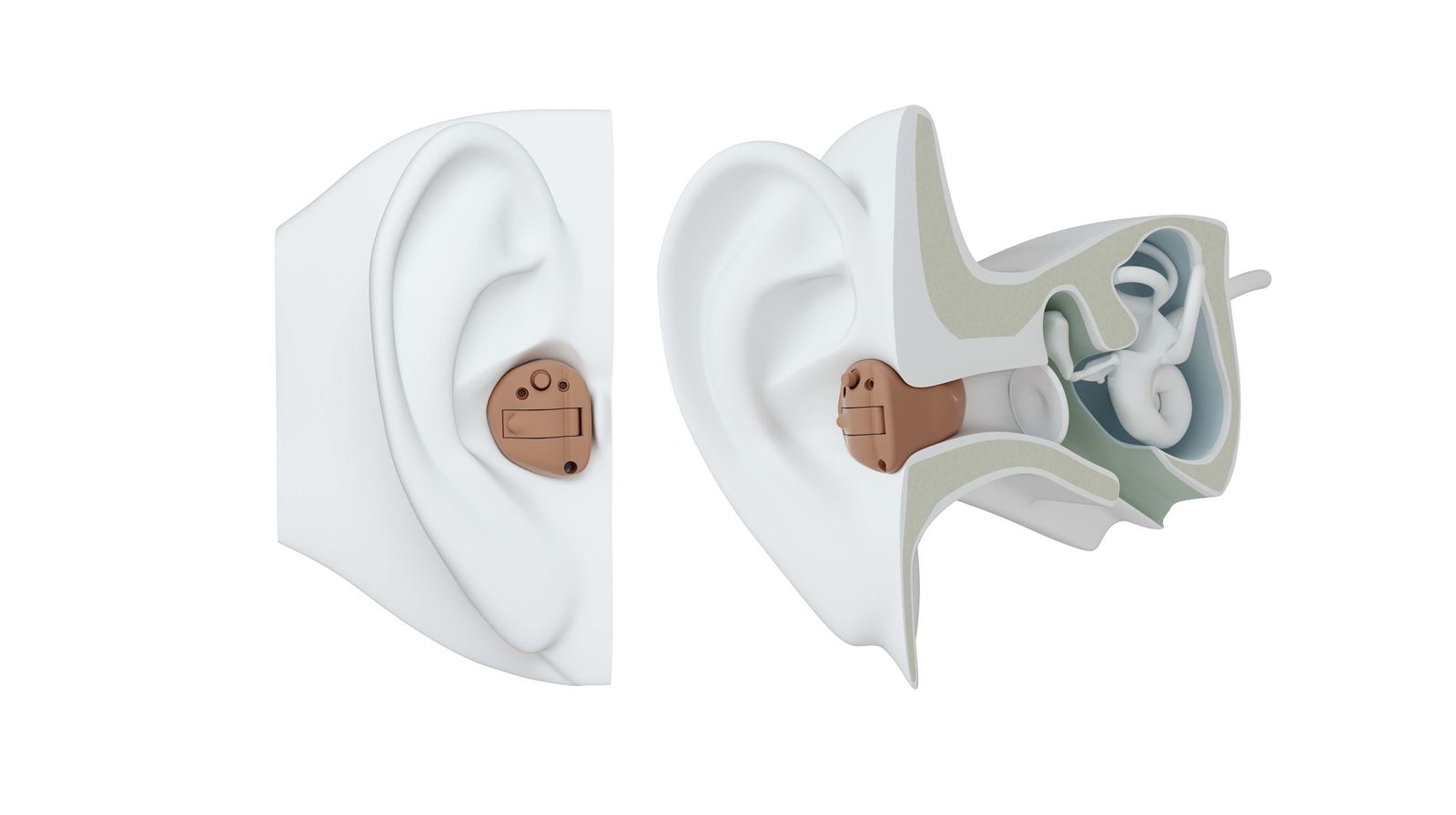 ReSound ITC Hearing Aid